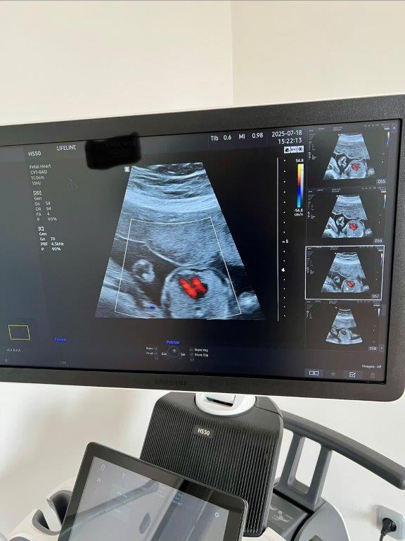 Használt Samsung HS50 típusú 2D/ 3D/ 4D/ 5D ultrahang készülék két vizsgálófejjel