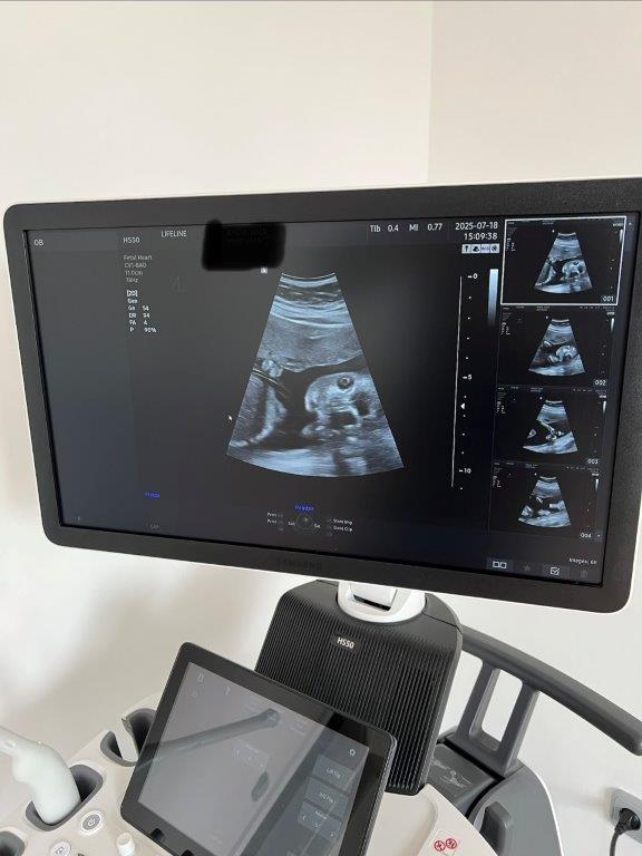 Használt Samsung HS50 típusú 2D/ 3D/ 4D/ 5D ultrahang készülék két vizsgálófejjel