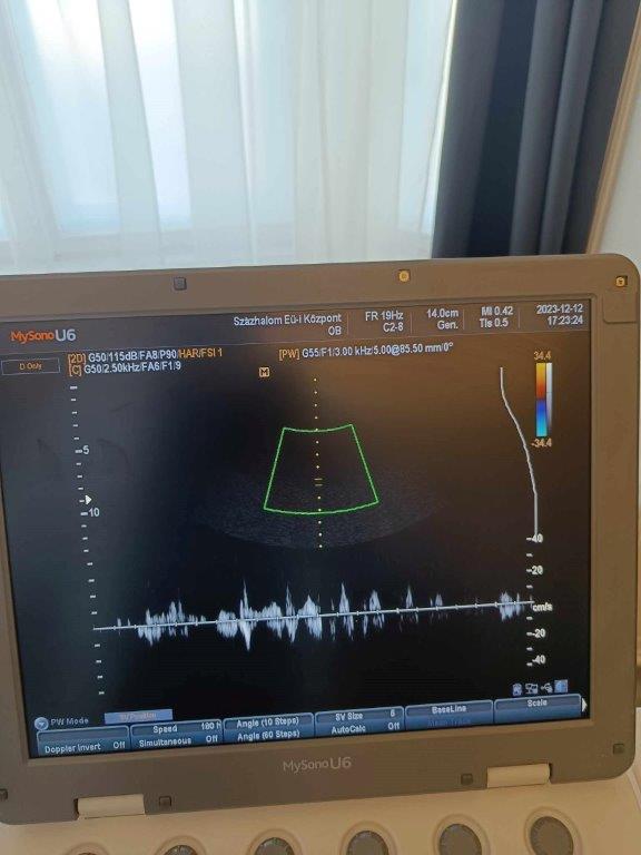 1. kép - Samsung Medison MySonoU6 hordozható ultrahang készülék hasi vizsgálófejjel 1. kép - Samsung Medison MySonoU6 hordozható ultrahang készülék hasi vizsgálófejjel