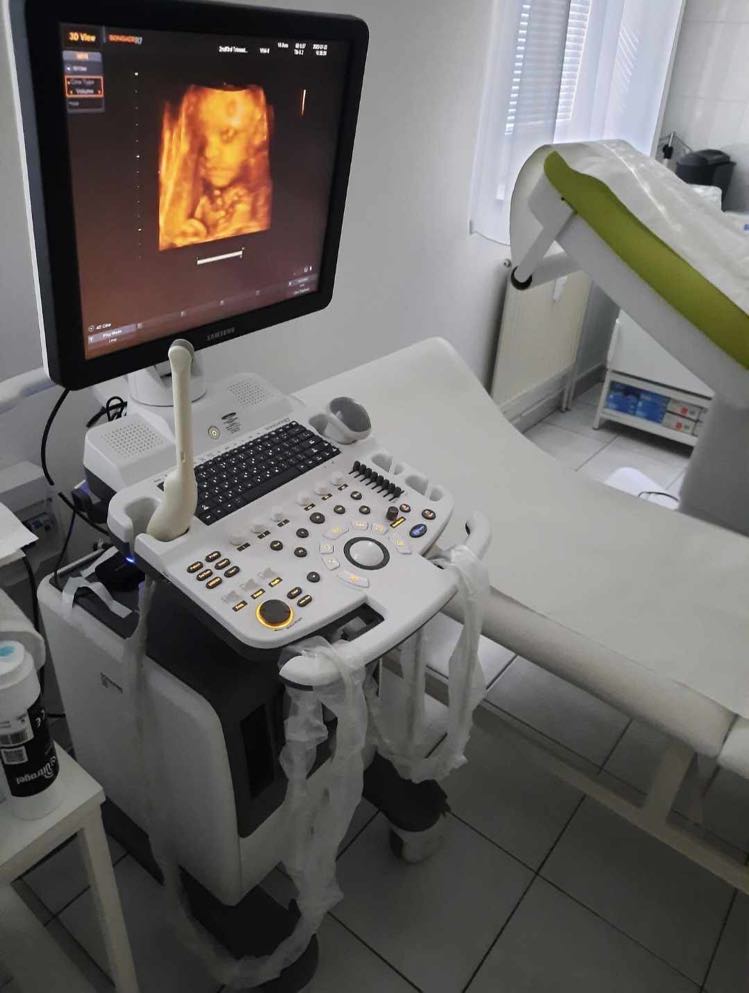 Használt SonoAce R7 szülészeti-nőgyógyászati ultrahang készülék két  vizsgálófejjel