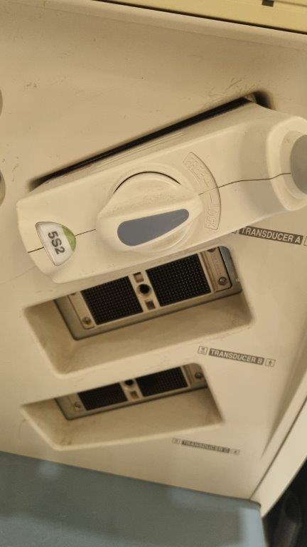 Használt Toshiba Xario SSA-660A kardiológiai ultrahang készülék Használt Toshiba Xario SSA-660A kardiológiai ultrahang készülék